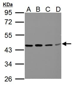 Polyclonal Rabbit anti-Human BCAT2 Antibody (aa1-332, IHC, WB)