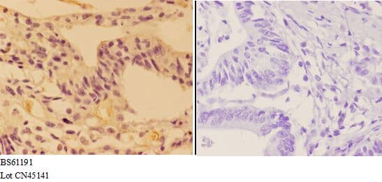 ALDOC / Aldolase C Antibody