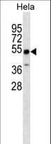 ZSCAN4 Antibody (aa94-120)