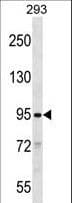SLITRK2 Antibody (aa773-801)