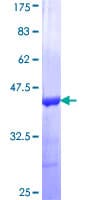Human CASQ2 / Calsequestrin 2 Protein (Recombinant GST, N-terminus)