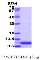 Human HSBP1L1 Protein (Recombinant His)