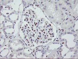 Monoclonal Mouse anti-Human MEIS3 Antibody (clone OTI3C9, IHC, WB)