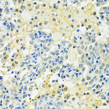Polyclonal Rabbit anti-Human SLC25A1 / SEA Antibody (IHC, WB)