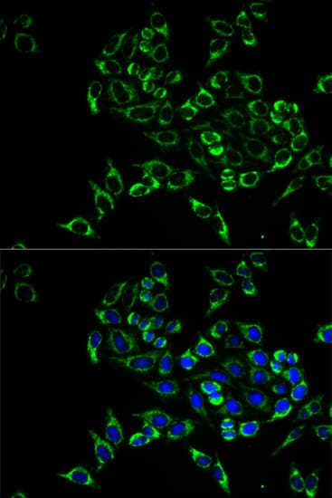 TNFSF11 / RANKL / TRANCE Antibody