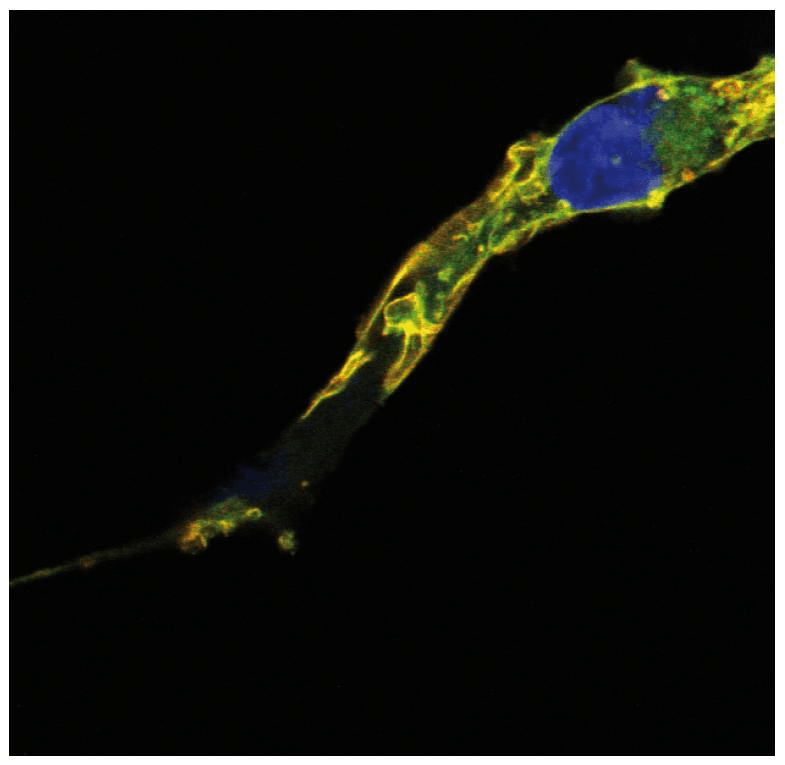 Monoclonal Mouse anti-Human TC21 / RRAS2 Antibody (clone EM-50, WB)
