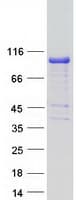 Human SH2B1 Protein (Recombinant Myc-DDK (Flag))