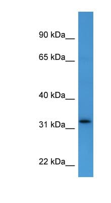 DOK4 Antibody (C-Terminus)