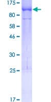 Human UNC84B / SUN2 Protein (Recombinant GST)