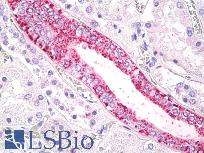 IHC-plus™ Polyclonal Rabbit anti-Human FFAR2 / GPR43 Antibody (Cytoplasmic Domain, IHC)