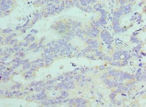 FGF1 / Acidic FGF Antibody (aa16-155)