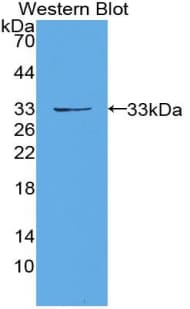 PRKD1 / PKC Mu Antibody (aa349-612)