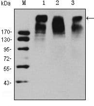 MKI67 / Ki67 Antibody (CEDLAGFKELFQTPG, clone 8D5)
