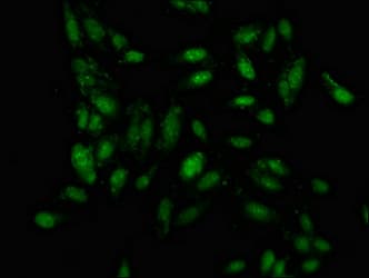Polyclonal Rabbit anti-Human IRF2BP1 Antibody (IHC, IF)