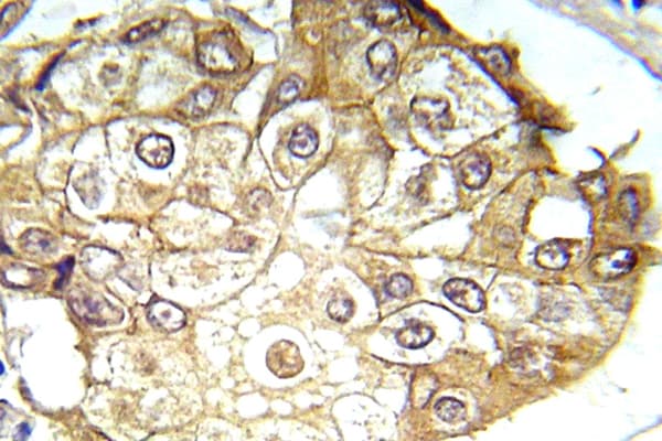 ERK1 + ERK2 Antibody (phospho-Thr202)