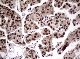 Monoclonal Mouse anti-Human NBN / Nibrin Antibody (clone OTI8E7, IHC, WB)