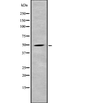 Polyclonal Rabbit anti-Human IRGC1 / CINEMA Antibody (WB)