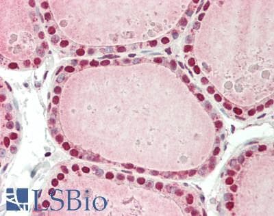 IHC-plus™ CCND2 / Cyclin D2 Antibody