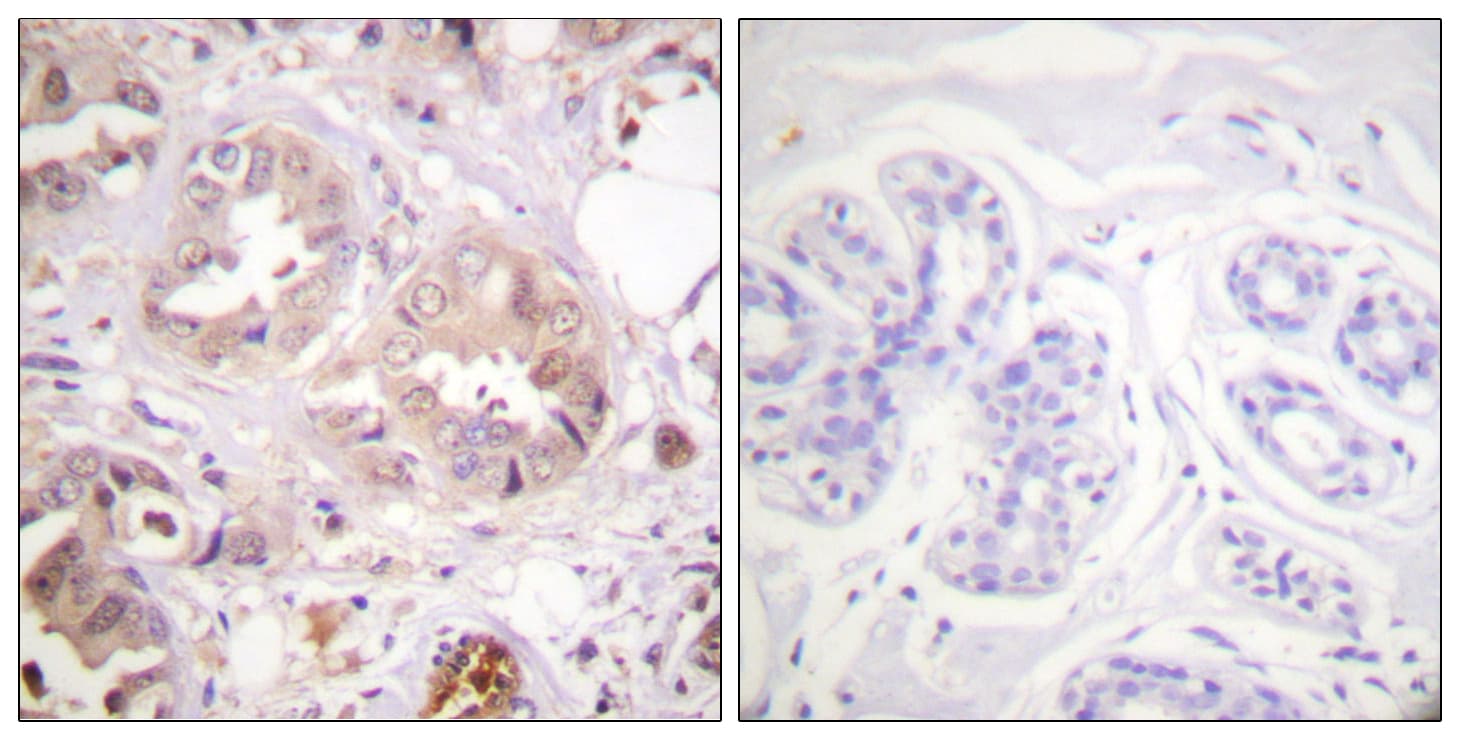 Polyclonal Rabbit anti-Human CDK7 Antibody (aa136-185, IHC, WB)