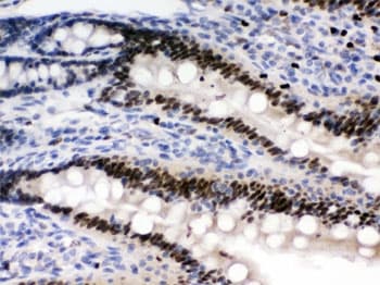 PRKAB2 / AMPK Beta 2 Antibody