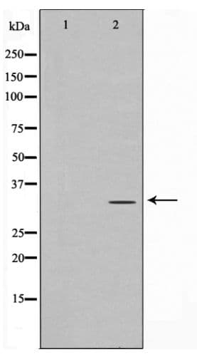 RPA2 / RFA2 / RPA34 Antibody (phospho-Thr21)