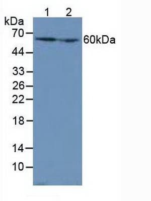 CAT / Catalase Antibody (aa32-157, HRP)