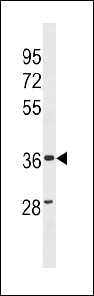 Polyclonal Rabbit anti-Human ZC3HAV1L Antibody (aa226-254, WB)
