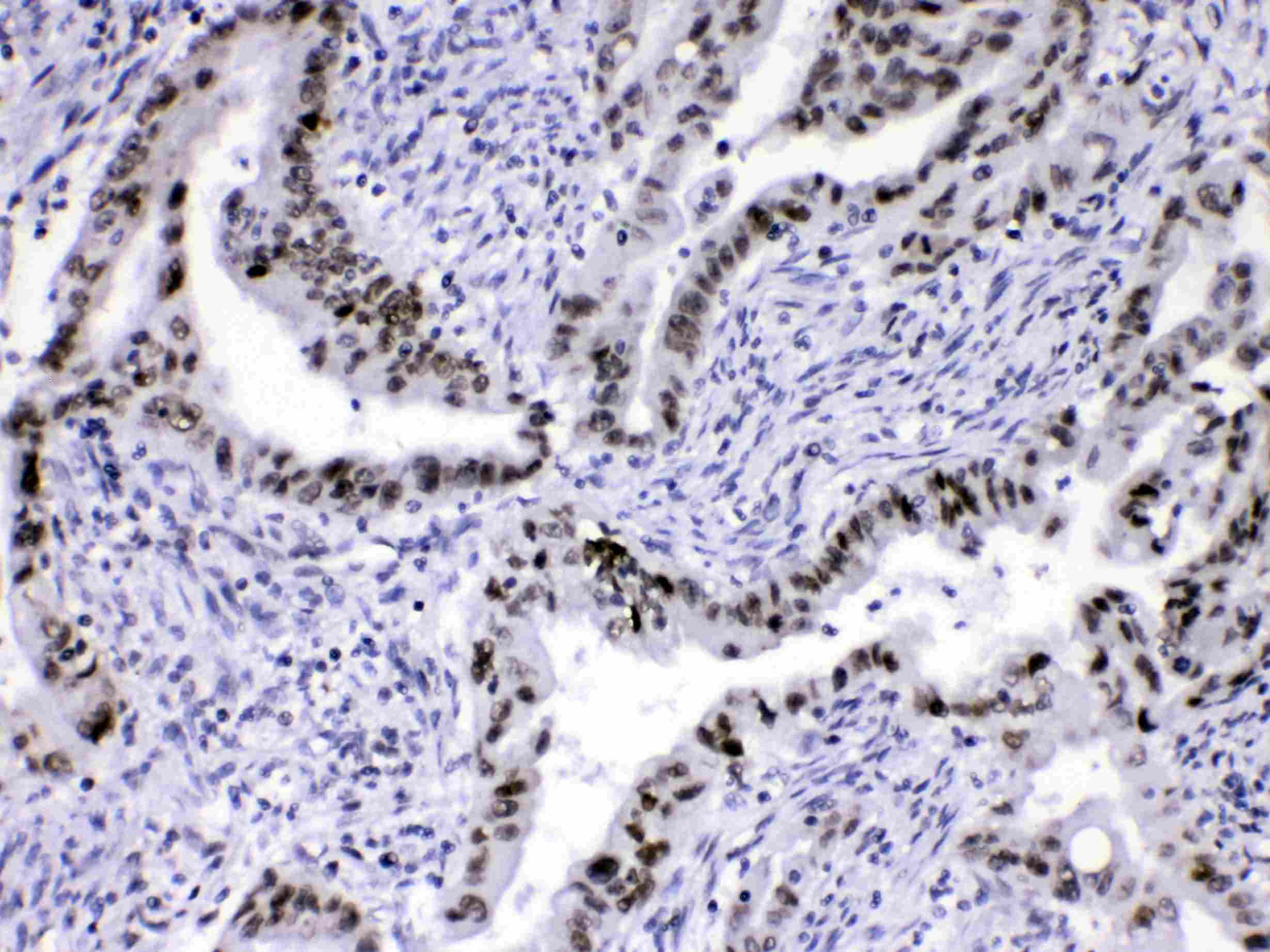 HNRPA1 / HnRNP A1 Antibody