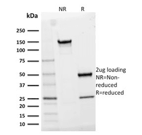 Monoclonal Mouse anti-Human IL2RA / CD25 Antibody (clone IL2RA/2395, Azide-free,BSA-free, IHC)