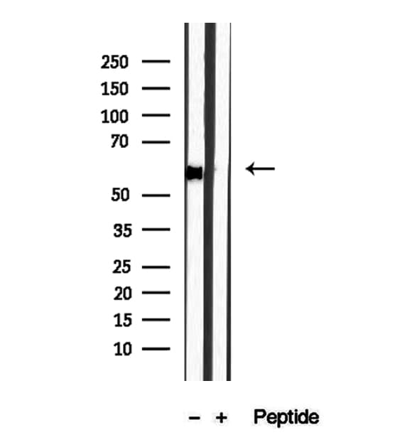 DBR1 Antibody