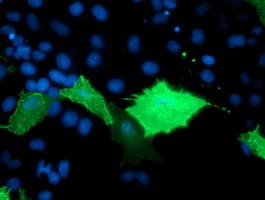 TULP3 Antibody (clone OTI6D8)