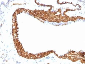 ACTA2 / Smooth Muscle Actin Antibody (N-Terminus, clone 1A4 + ACTA2/791)