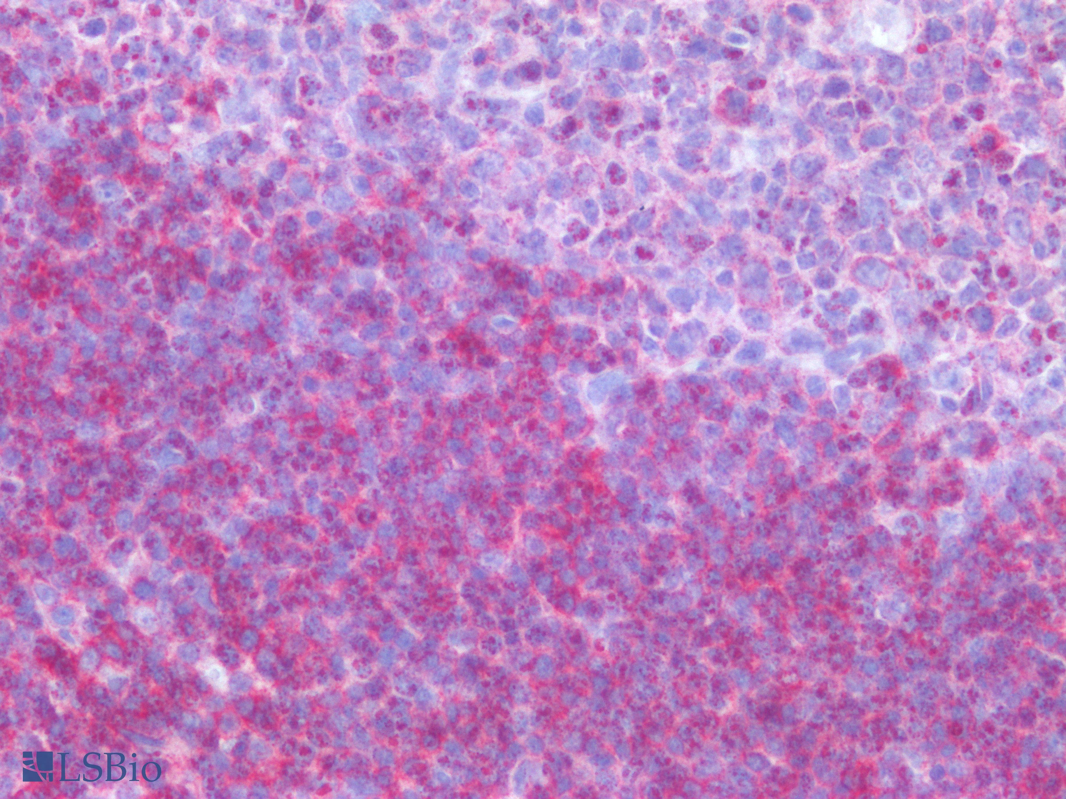 IHC-plus™ Monoclonal Mouse anti-Human CD79B / CD79 Beta Antibody (clone CB3-1, IHC, WB)