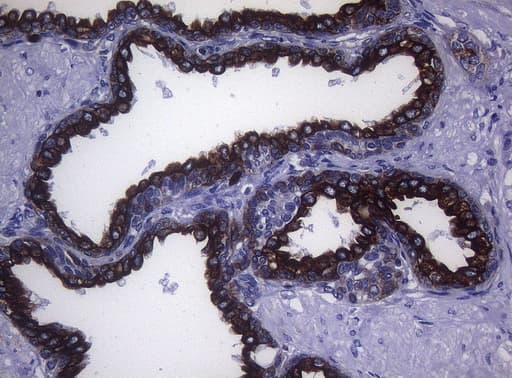 Monoclonal Mouse anti-Human KRT18 / CK18 / Cytokeratin 18 Antibody (clone OTI5E4, aa69-372, IHC, WB)