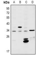 Polyclonal Rabbit anti-Human MSX2 / MSH Antibody (IHC, WB)