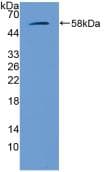 GBA / Glucosidase Beta Acid Antibody (aa255-509)