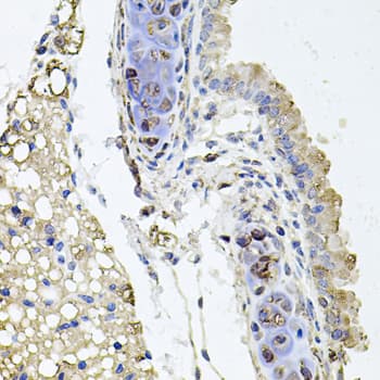 Polyclonal Rabbit anti-Human RHOT1 Antibody (IHC, WB)