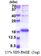 Human LBH Protein (Recombinant His)