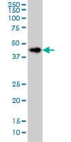 CerS6 / LASS6 Antibody (clone 5H7)