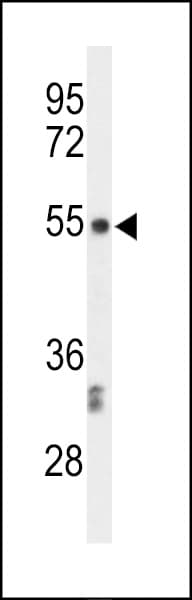 CENPI / CENP-I Antibody (aa388-414)