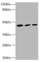 Polyclonal Rabbit anti-Human IDH1 / IDH Antibody (aa1-240, IHC, WB)