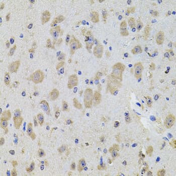 Polyclonal Rabbit anti-Human KCNJ3 / GIRK1 Antibody (IHC, WB)