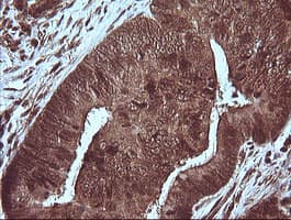 MAP2K1 / MKK1 / MEK1 Antibody (clone OTI2A1, Carrier-free)
