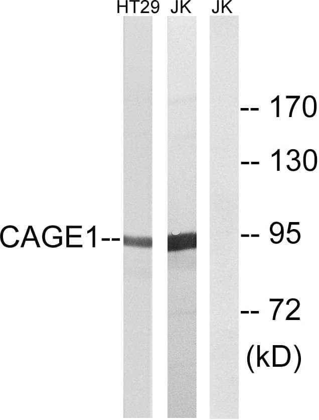CAGE1 / Cancer Antigen 1 Antibody
