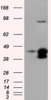 IHC-plus™ Monoclonal Mouse anti-Human DAPK2 / DAP Kinase 2 Antibody (clone 1B5, IHC, IF, WB)