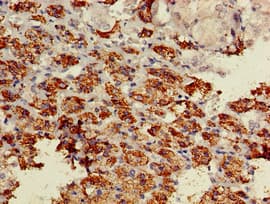 BACE1 / BACE Antibody