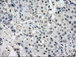 KDM4C / JMJD2C Antibody (clone OTI5B9)
