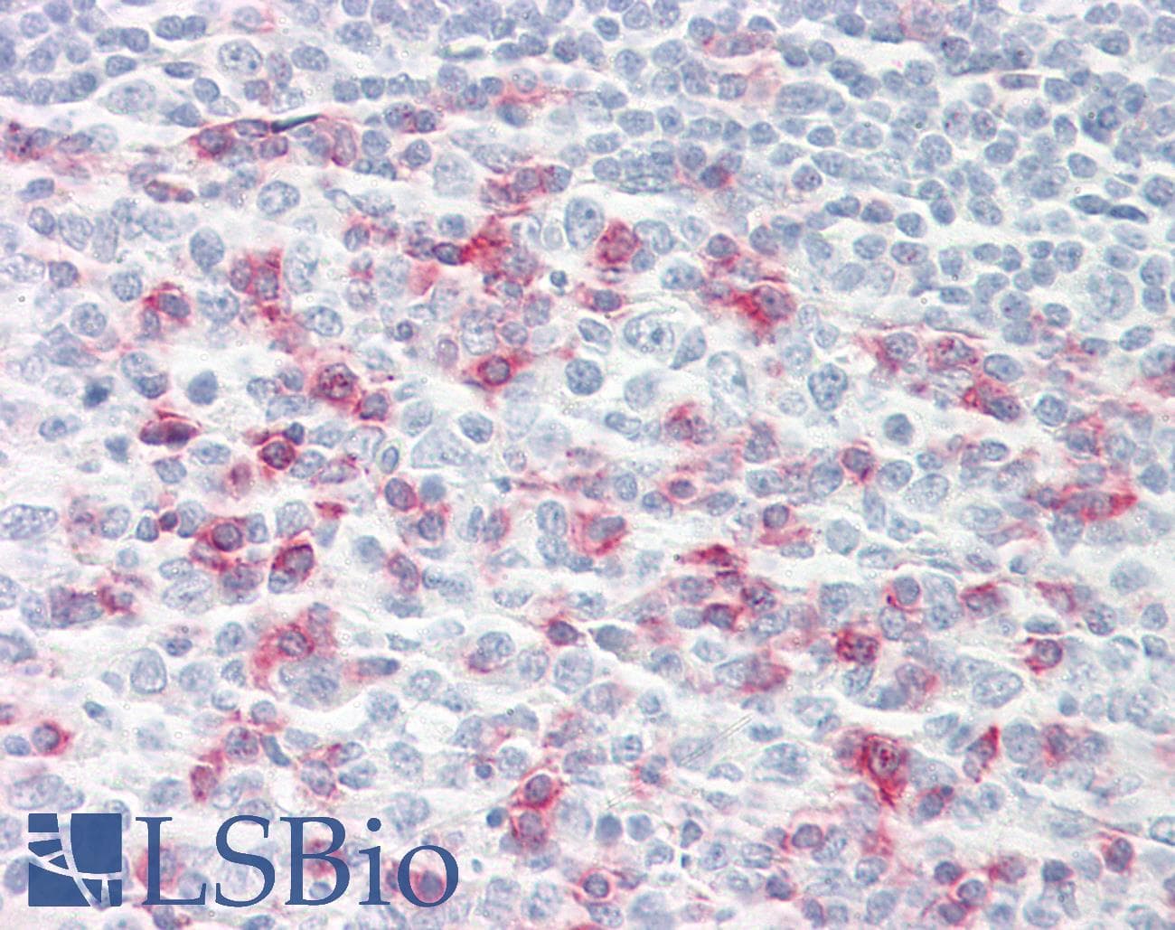IHC-plus™ PDCD1 / CD279 / PD-1 Antibody (clone J116)