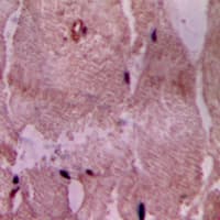 Polyclonal Rabbit anti-Human ACOT9 Antibody (Internal, IHC, WB)