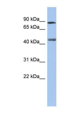 RARG / RAR-Gamma Antibody (aa143-192)